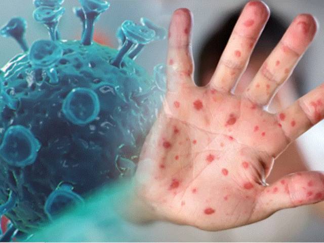 Вирус оспы обезьян (mpox)